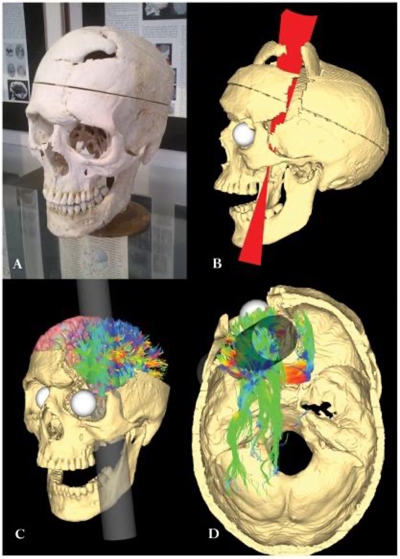 Skull Surprise  Harvard Medical School